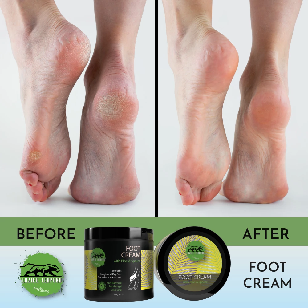 Foot Cream With Pine & Spruce (100g)